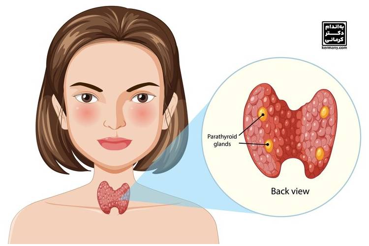اختلال تیروئید چیست؟ - 8 - اختلال تیروئید - بیماری و درمان