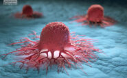 مرگ سلول های سرطانی با پدیده‌ی ساده‌ای به نام گرما