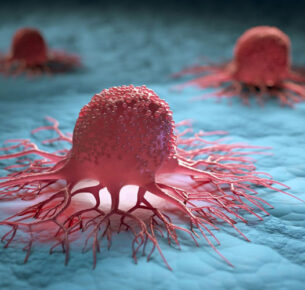 مرگ سلول های سرطانی با پدیده‌ی ساده‌ای به نام گرما