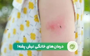 بهترین راه های درمان نیش پشه در خانه