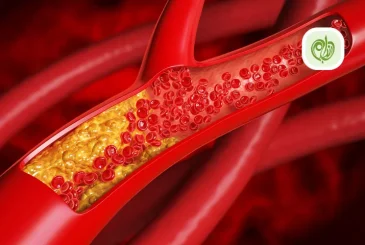 مقاله روش های درمان چربی خون