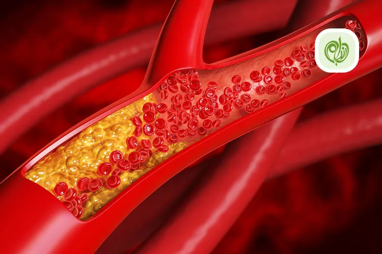 مقاله روش های درمان چربی خون