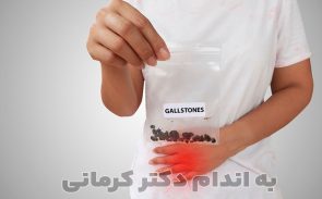 دفع سنگ کیسه صفرا