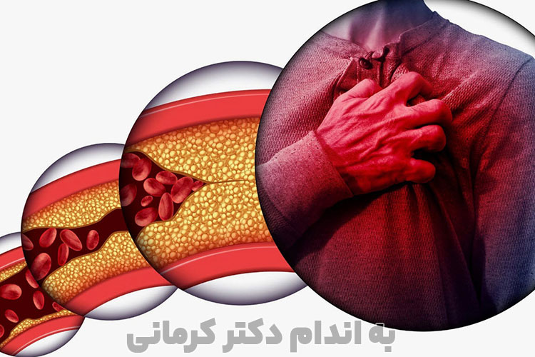 چربی خون و علائم آن