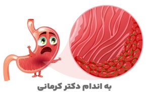 گاستریت یا ورم معده