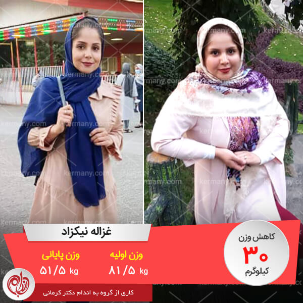 غزاله نیکزاد وزن اولیه: 81.5 وزن پایانی: 51.5 میزان کاهش وزن: 30 کیلو