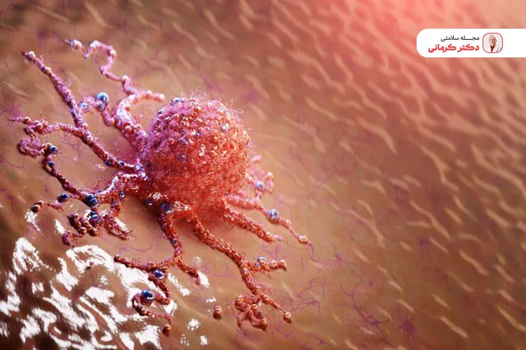 علت سرطان پوست