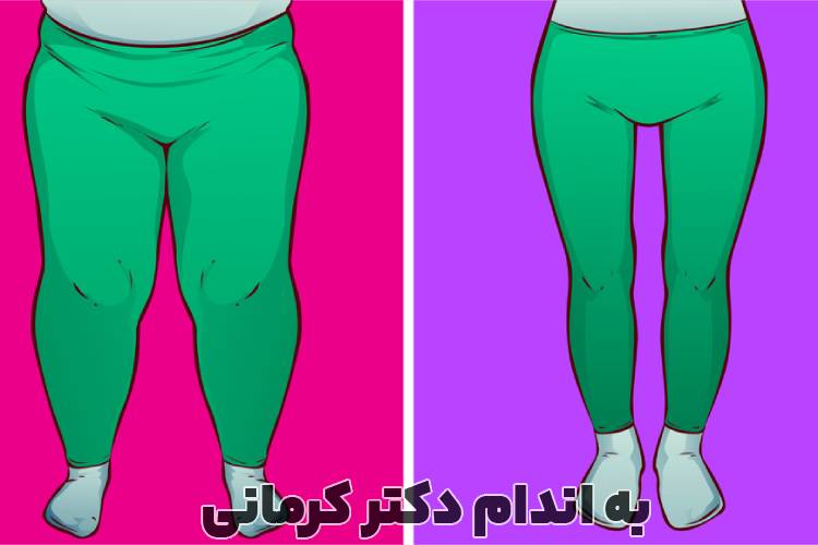 مقاله لاغری ران