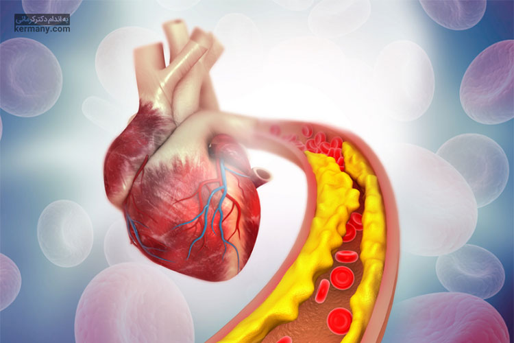 ترب سیاه تشکیل کلسترول را کاهش داده و به طور غیر مستقیم خطر حمله قلبی را کاهش می‌دهد.