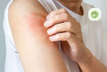 مقاله برای درمان خشکی پوست چه بخوریم؟