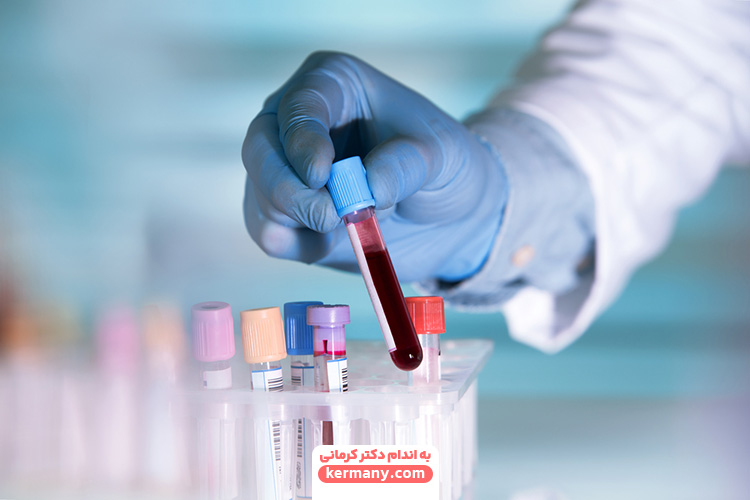 آزمایش خون برای کمبود بیوتین