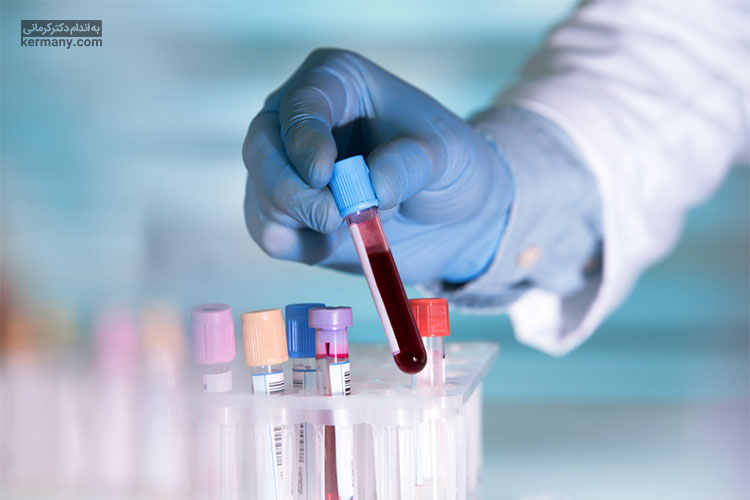 مصرف مکمل‌های بیوتین ممکن است با نتایج بسیاری از آزمایش‌های خون تداخل داشته باشد.