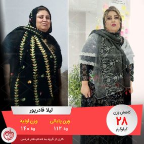 لیلا قادرپور رکورددار کاهش وزن رژیم دکتر کرمانی