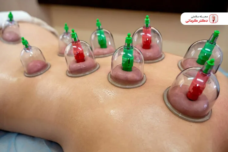 برای تسریع خوب شدن زخم حجامت تغذیه مناسب ضروری است.