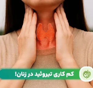 کم کاری تیروئید در زنان