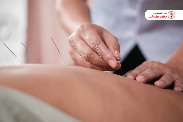 طب سوزنی یکی از روشهای درمان فوری کبد چرب