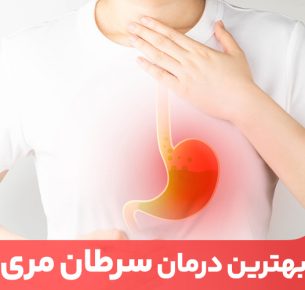 درمان سرطان مری در مراحل اولیه، با کمک دارو و تغذیه مناسب، قابل درمان است.