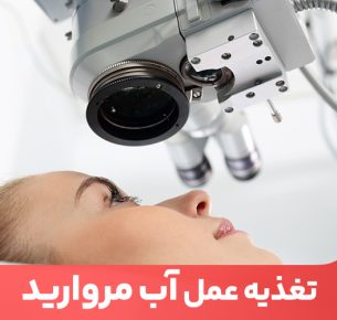 تغذیه عمل آب مروارید و رعایت اصول غذایی که پزشک تجویز می‌کند به بهبود سریع‌تر چشم‌های شما کمک خواهد کرد.