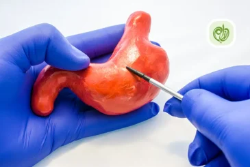 مقاله رژیم غذایی مناسب بعد از عمل اسلیو معده