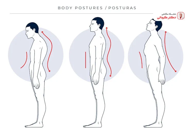 اگر انحنای پایین کمر بیش از حد به سمت داخل باشد باشد به آن گودی کمر میگویند.