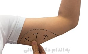 برای لاغری بازو باید از یک رژیم لاغری مناسب برای کاهش وزن کلی بدن خود کمک بگیرید.