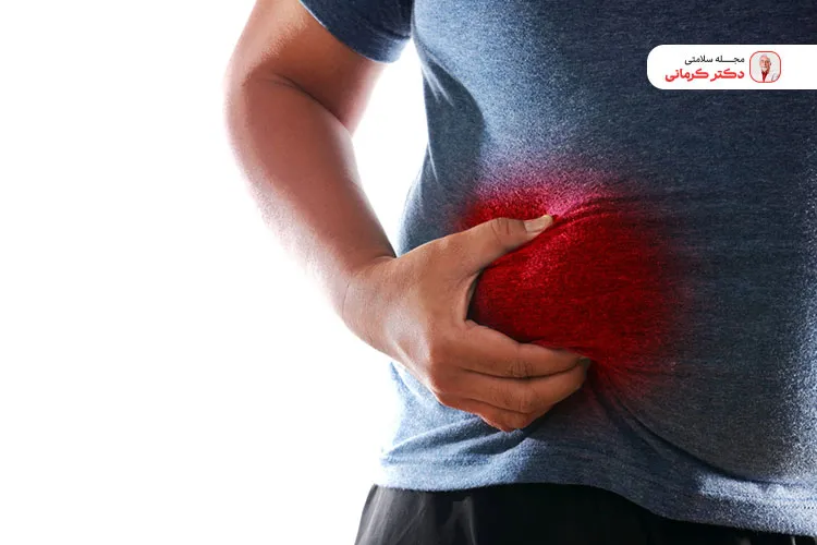 یکی  از عوارض قرص cla تجمع چربی در کبد است.