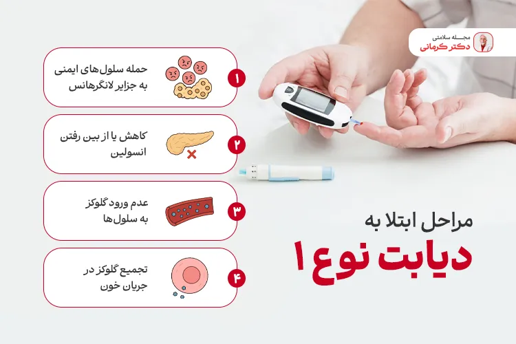 مراحل ابتلا به دیابت نوع 1