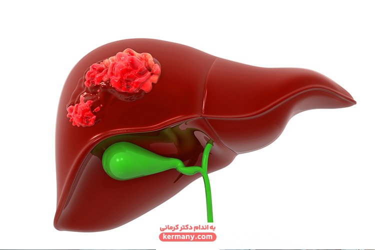 کیسه صفرا چیست؟ - 1 - صفرا چیست - بیماری و درمان