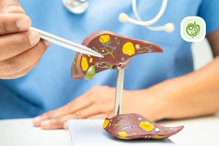 مقاله صفرا چیست