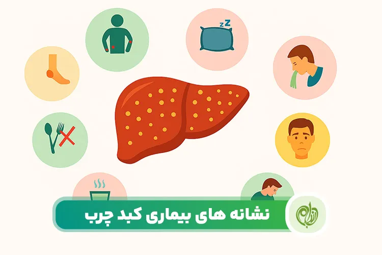 مقاله علائم کبد چرب