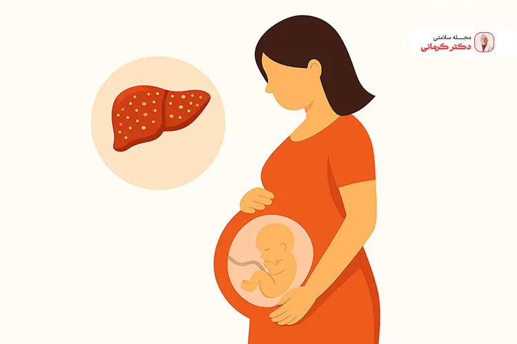 علائم کبد چرب در بارداری