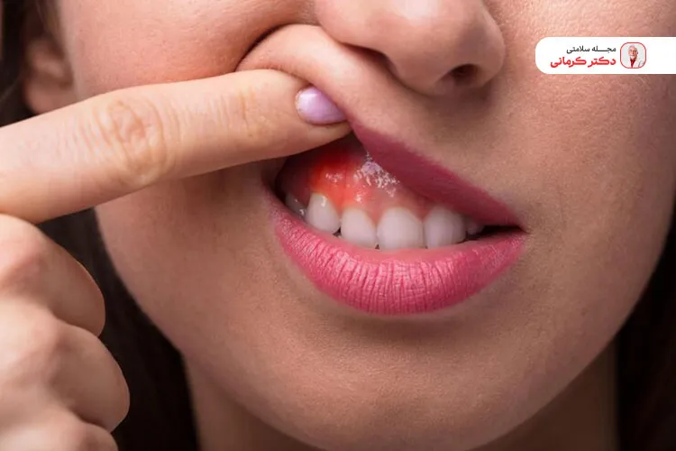 علائم کبد چرب گرید 3