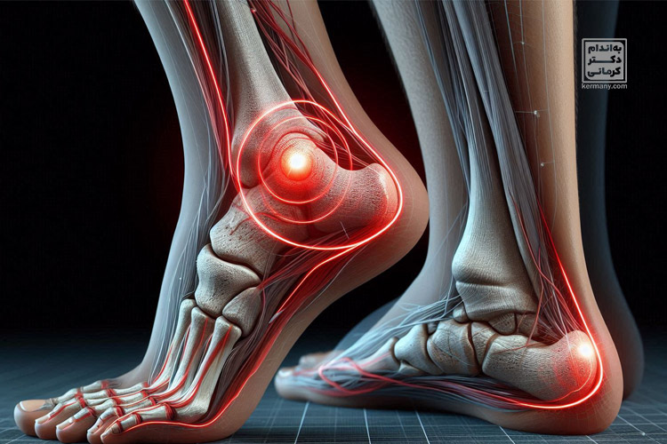 درد پاشنه پا - 1 - درد پاشنه پا - بیماری و درمان