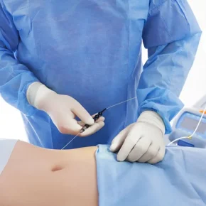 مقاله عمل لیپولیز شکم چیست؟