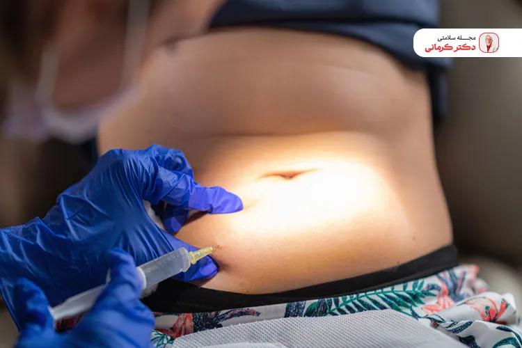 هر دو نوع لیپولیز تهاجمی و غیر تهاجمی منجر به کاهش وزن می‌شود.