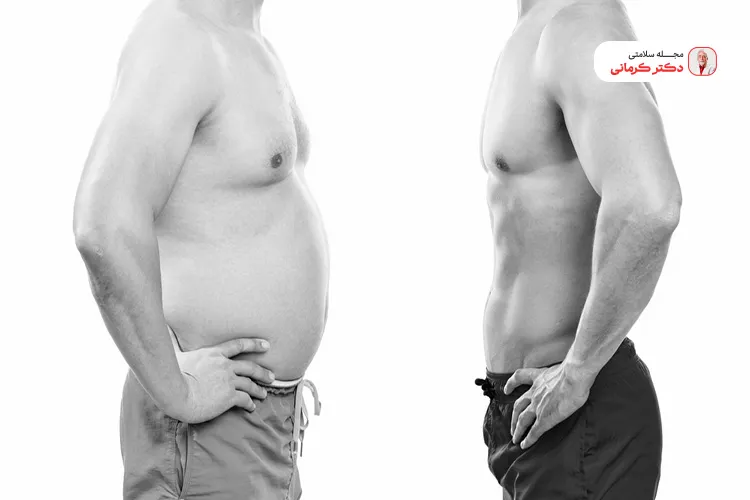 بهترین روش به جای عمل لاغری لیپولیز لاغری با رژیم غذایی و روزش است.