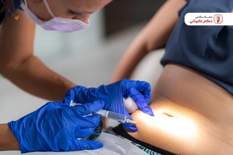 عمل لیپولیز نوعی روش غیر تهاجمی برای پیکرتراشی است.