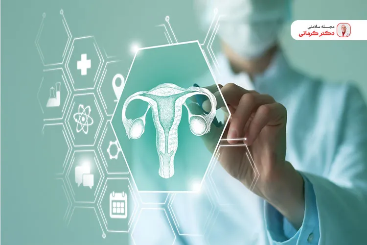 یکی از مهمترین دلایل چاقی در خانم‌ها سندرم تخمدان پلی کیستیک است.