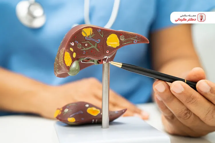 یکی از مهمترین علل اضافه وزن سیروز کبدی است.