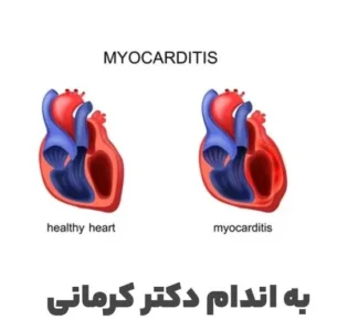 التهاب عضله قلب