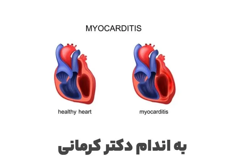 التهاب عضله قلب