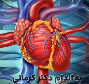 باز شدن رگ‌های قلب