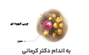 چربی قهوه ای چیست