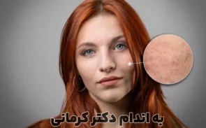 درمان پوست مرغی