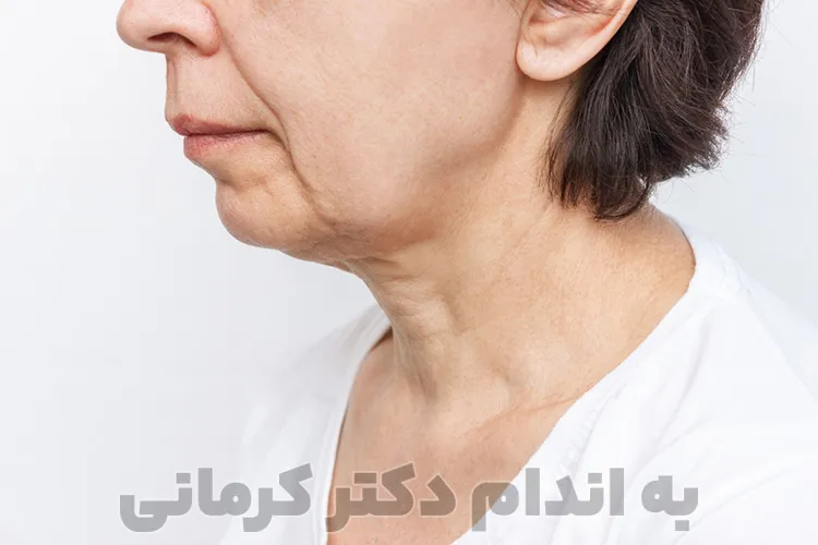 مشکل لاغری صورت در رژیم کاهش وزن به چند عامل مهم بستگی دارد.