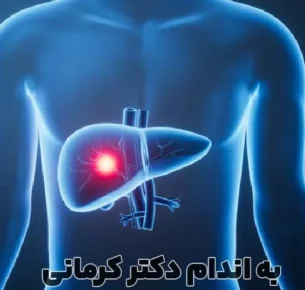 فیبروز کبد