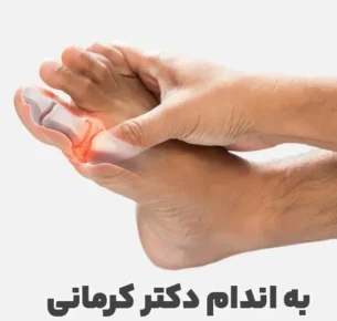 نقرس