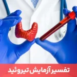 مقاله آزمایش تیروئید برای بررسی نحوه عملکرد غده تیروئید تجویز می‌شود.