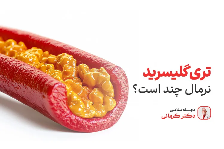 تری گلیسیرید نرمال چند است؟