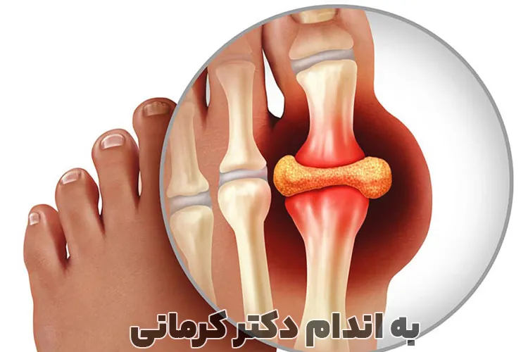 اوریک اسید